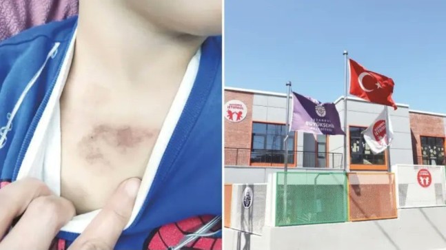 İBB KREŞİNDE ÇOCUK İSTİSTİMARI İDDİASI